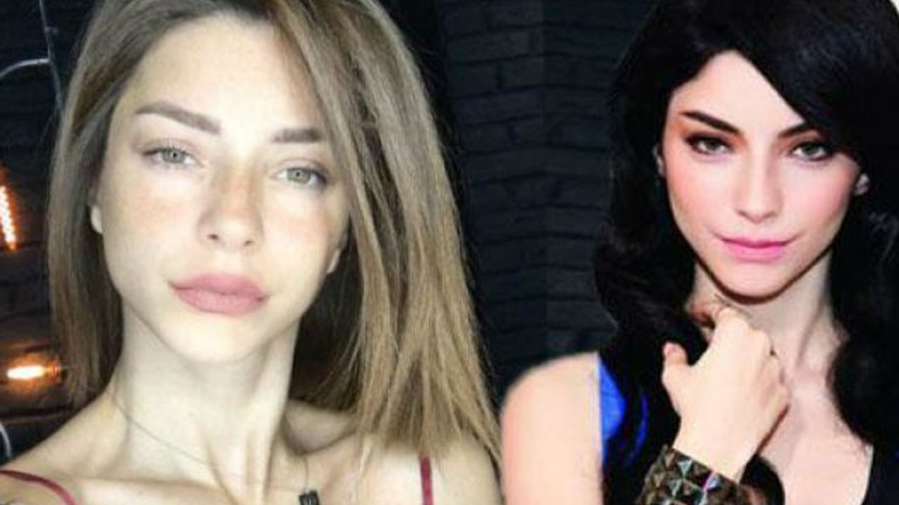 Merve Boluğur estetik mi yaptırdı?