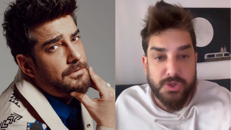 Enis Arıkan protez saçını çıkardı: Doğal hali olay oldu!