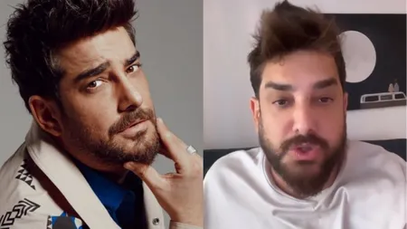 Enis Arıkan protez saçını çıkardı: Doğal hali olay oldu!