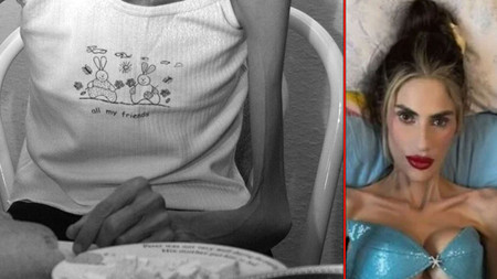 Nihal Candan'ın ölümünün ardından gündem olan anoreksiya nervoza hakkında bilinmesi gerekenler