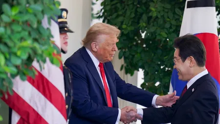 Trump'ın elindeki morluk dikkatlerden kaçmadı! Beyaz Saray açıklama yapmak zorunda kaldı