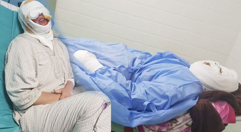 Kocası Zehra'yı uyurken kızgın yağ dökerek yaktı