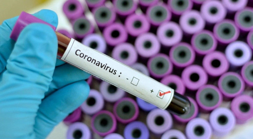 Sağlık Bakanlığı'ndan yeni Coronavirus tedbirleri!