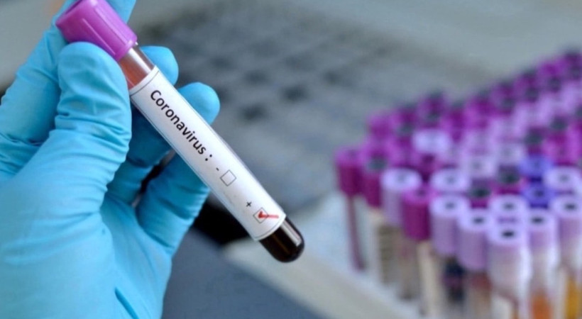 Bilim Kurulu üyesi tarih verdi! Coronavirus salgını ne zaman biter?