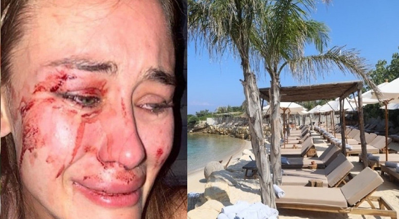 Çeşme'deki darp rezaletine Momo Beach'ten açıklama