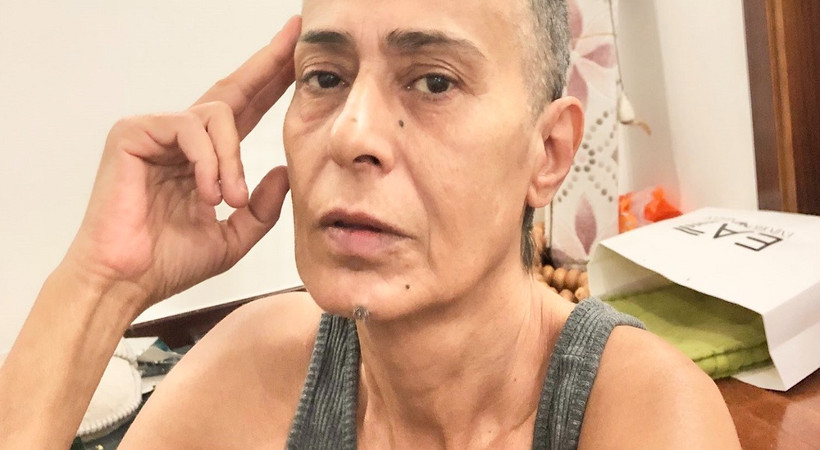 Yıldız Tilbe saçlarını kazıttı