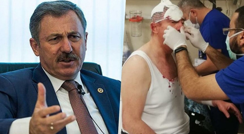 Selçuk Özdağ’a saldırı davası: Yaralama değil öldürmeye teşebbüs