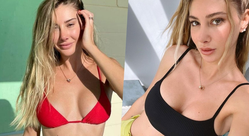 Estetik ameliyatı olan Şeyma Subaşı hastanelik mi oldu?