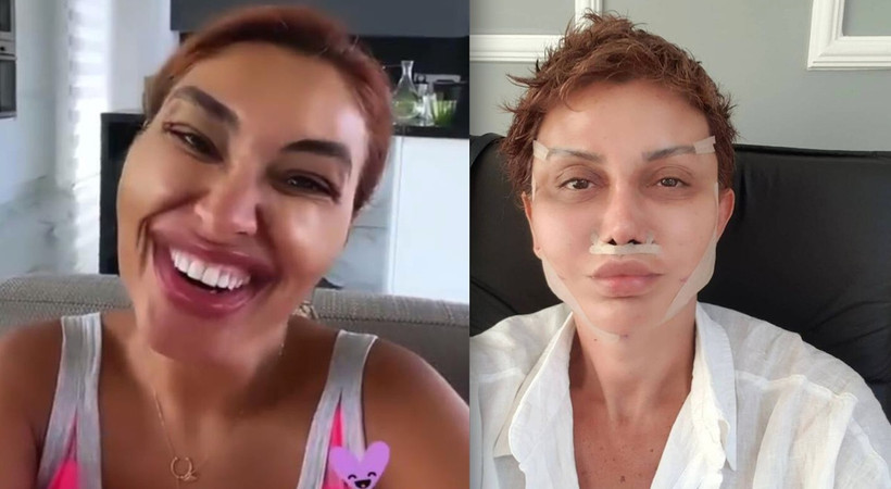 Zuhal Topal filtre kullanarak yaptığı paylaşımda, Fransız askısı yaptırıp fotoğraf paylaşan Serap Aköz'ün estetiğini ti'ye aldı...