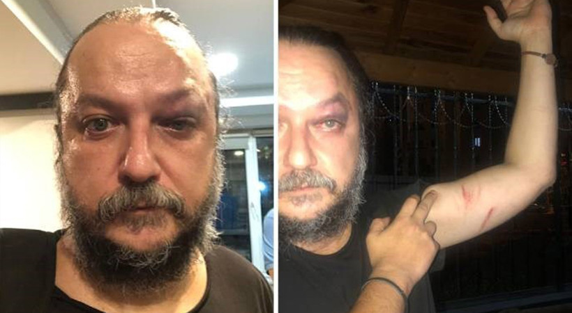 Güvenç Dağüstün’e saldıranlar yakalandı: Silahlı, mermili ve bıçaklı fotoğrafları ortaya çıktı