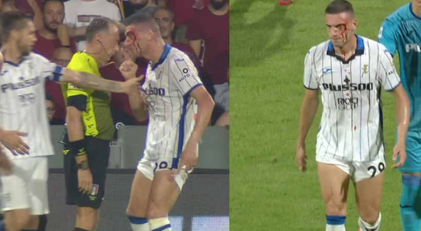 Merih Demiral kanlar içinde kaldı