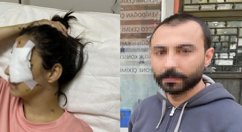 Böyle bir vahşet görülmedi. Eline öpmeyen yeğenini dövdü, çocuğun annesinin gözüne bıçak sapladı. Saldırgan Recep İlgar'ın annesi vahşete isyan etti: Oğlum idam edilsin