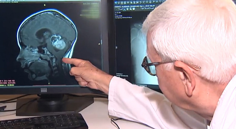 Beyin kanamasını 1 dakikada tespit eden yapay zeka yazılımı Türkiye'de ilk kez Cerrahpaşa Tıp Fakültesi Hastanesi'nde