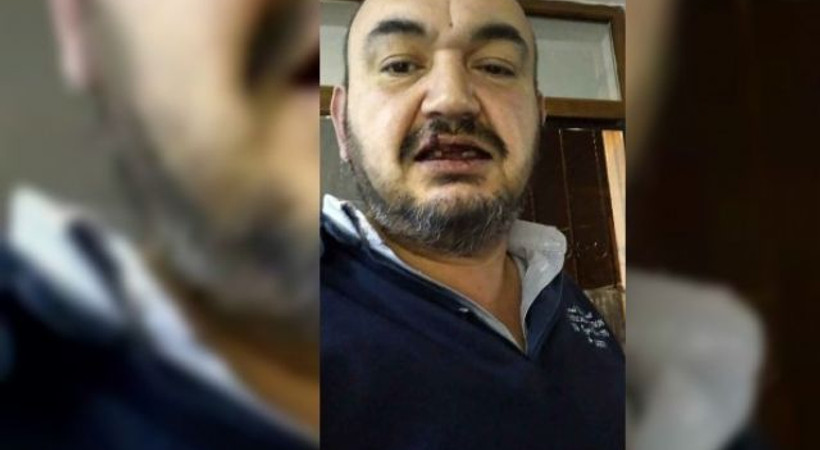 Maslak'ta dehşet! Uber sürücüsü 10 kişinin saldırısına uğradı!