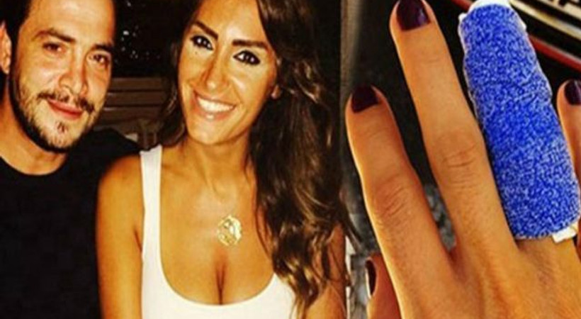 Yaşadığı şiddeti canlı yayında anlattı: Gülerek parmağımı kırdı