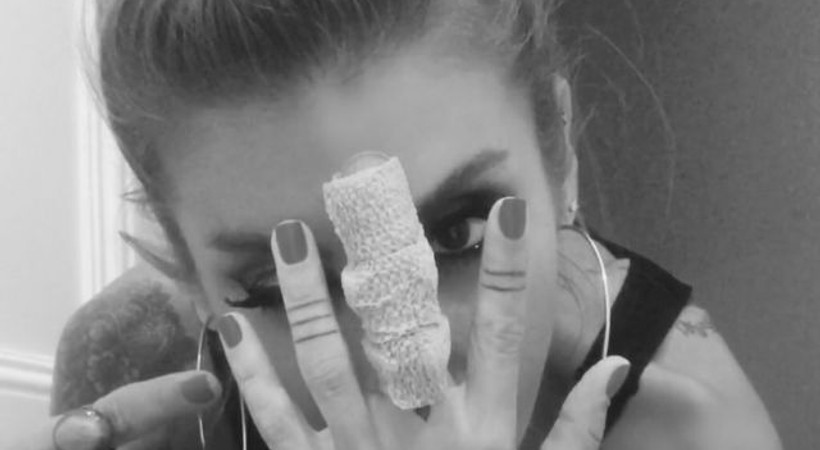 İrem Derici'nin kırılan parmağıyla ilgili ilginç detay