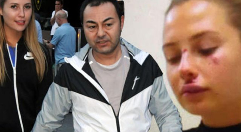 Serdar Ortaç’ın eşi Chloe Miami'de kaza geçirdi!
