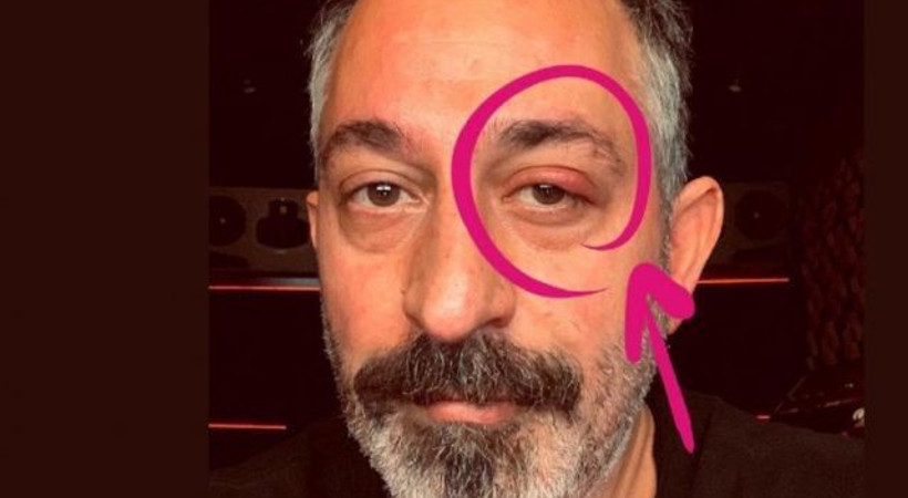 Cem Yılmaz nazara geldi!