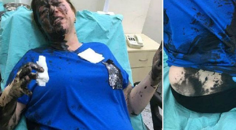 İş kadınını darp edip, yanıcı madde döken zanlı tutuklandı!