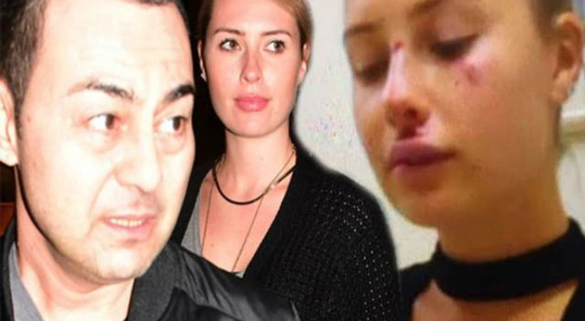 Ölümden dönmüştü! İlk paylaşımı korkuttu