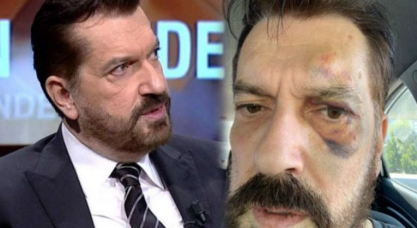 SONAR Araştırma Şirketi’nin sahibi Hakan Bayrakçı'ya saldırı