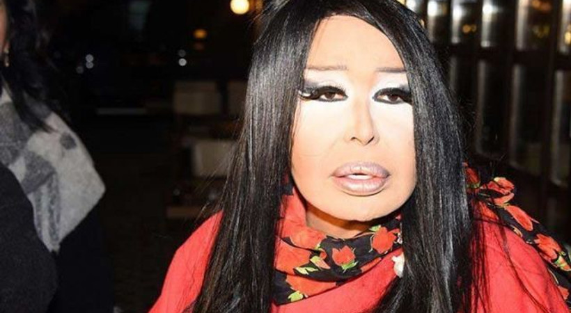 Bülent Ersoy’un dişi kırıldı! Sağlık ekipleri taksi içerisinde müdahale etti