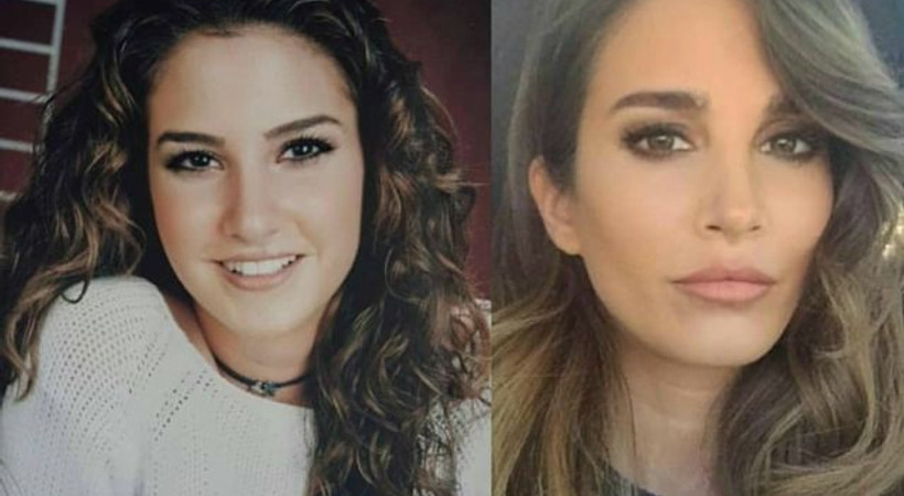 Çarpışma dizisinin oyuncusunun estetik isyanı!
