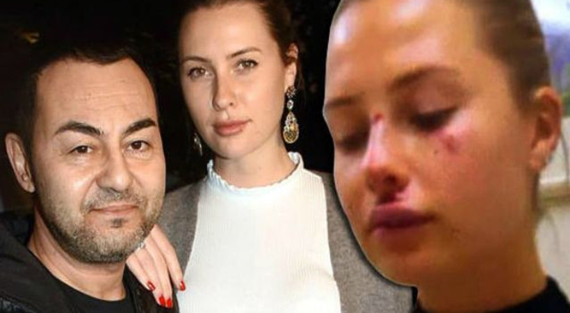 Serdar Ortaç'tan açıklama geldi! 'Karısı darp edildi' diyorlarmış...