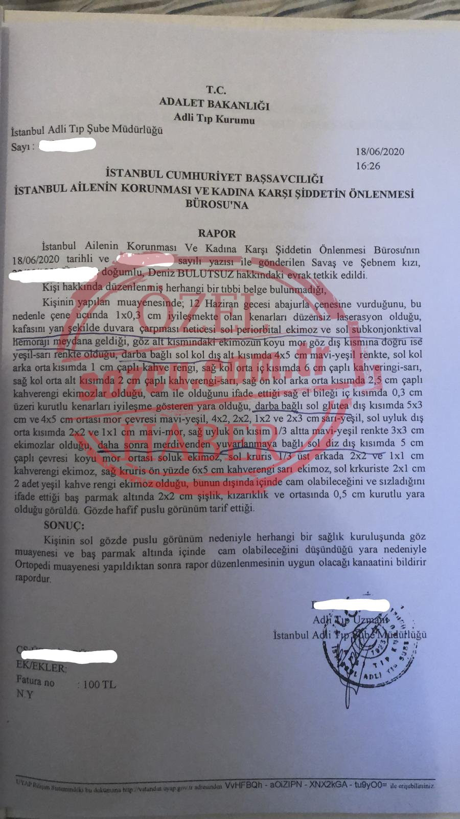 Ozan Guven Den Siddet Gordugunu Iddia Eden Deniz Bulutsuz Un Adli Tip Raporu Ortaya Cikti